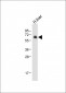 UGT2B15 Antibody (Center)